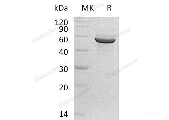 Recombinant Human PACSIN1/Syndapin-1 Protein(C-6His)-Elabscience