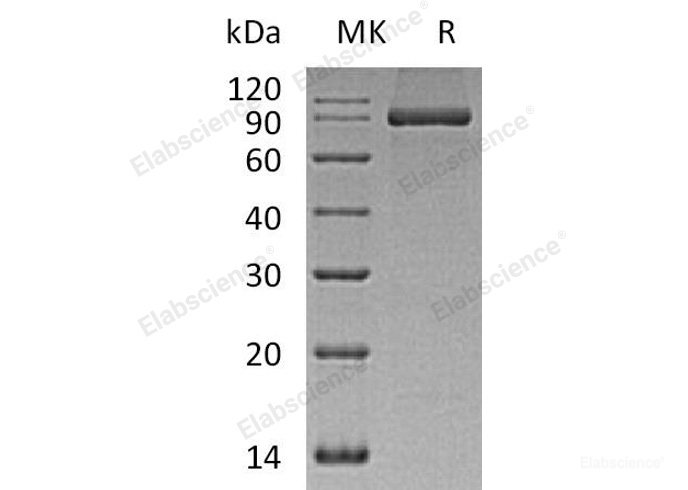 Recombinant Human PACSIN2/Syndapin-2 Protein(C-6His)-Elabscience