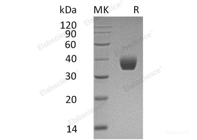 Recombinant Human Palmitoyl-Protein Thioesterase 1/PPT1 Protein(C-6His)-Elabscience