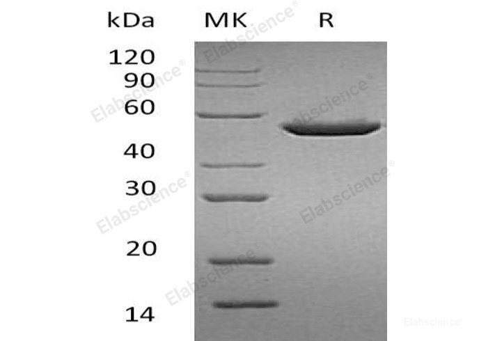 Recombinant Human Pancreatic Lipase-Related Protein 1/PLRP1 Protein(C-6His)-Elabscience