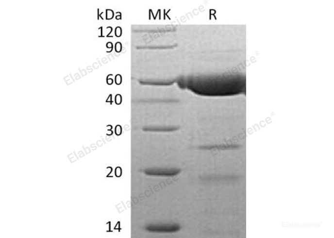 Recombinant Human Pancreatic Lipase-Related Protein 2/PLRP2 Protein(C-6His)-Elabscience