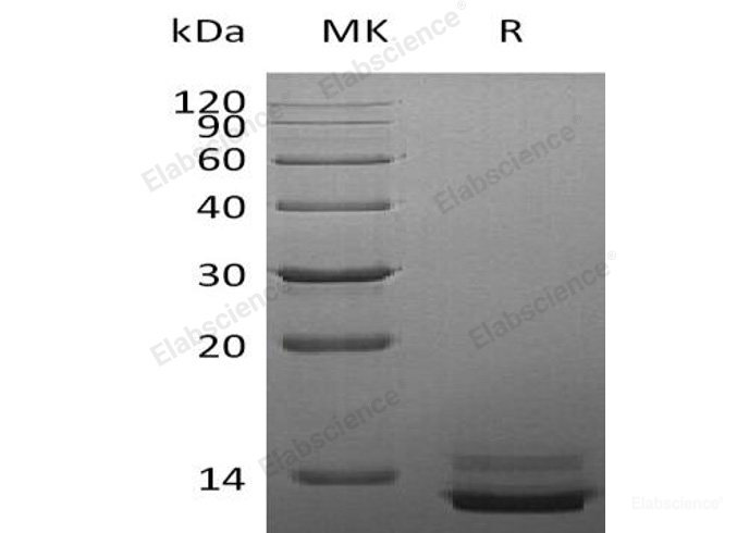 Recombinant Human Pancreatic Polypeptide/PPY Protein(C-6His)-Elabscience