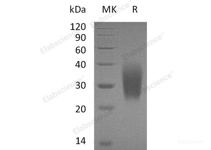 Recombinant Human Parathyroid Hormone 1 Receptor/PTH1R Protein(Gly49, C-6His)-Elabscience