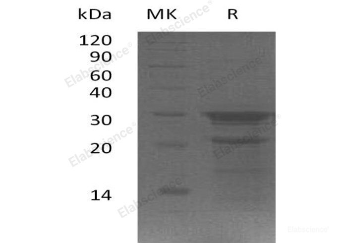 Recombinant Human Partner of Y14 and Mago/WIBG /PYM Protein(C-6His)-Elabscience