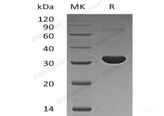 Recombinant Human PBLD/MAWBP Protein(N-6His)-Elabscience