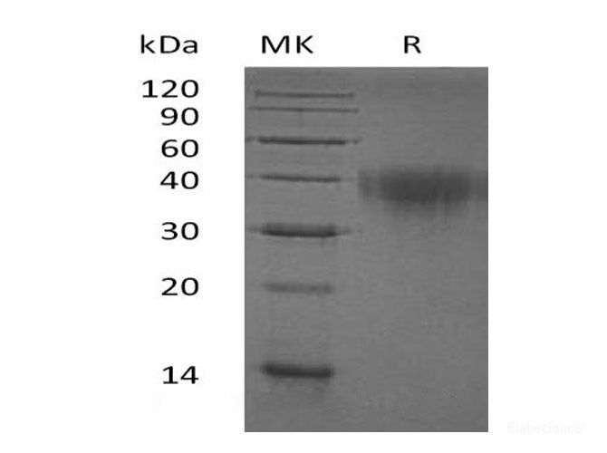 Recombinant Human PDCD1/PD-1/CD279 Protein(C-6His)-Elabscience