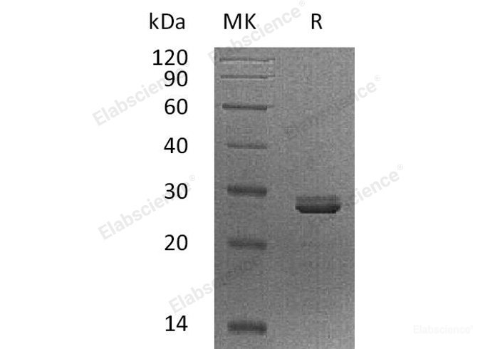 Recombinant Human PDCD10/TFAR15 Protein-Elabscience