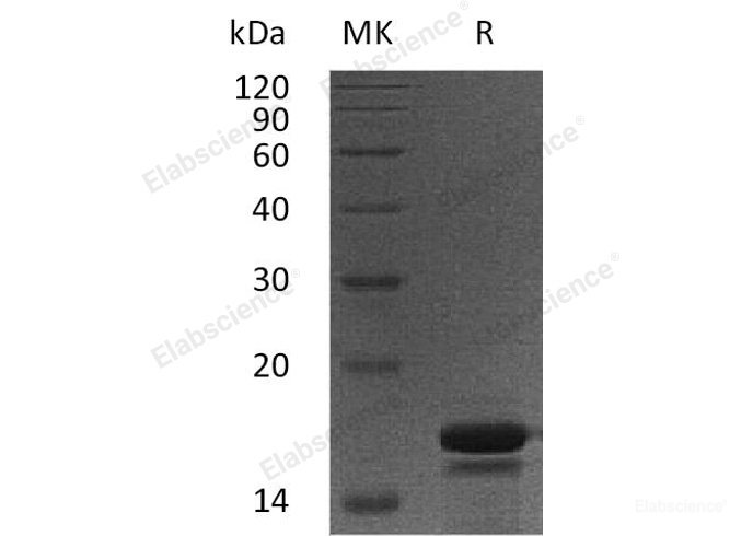 Recombinant Human PDCD5/TFAR19 Protein(N-6His)-Elabscience