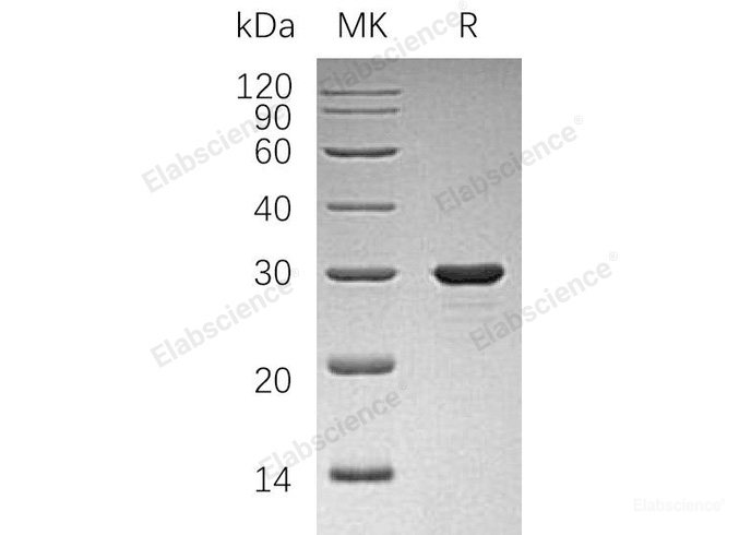 Recombinant Human PDGF-Associated Protein/PAP Protein(N-6His)-Elabscience