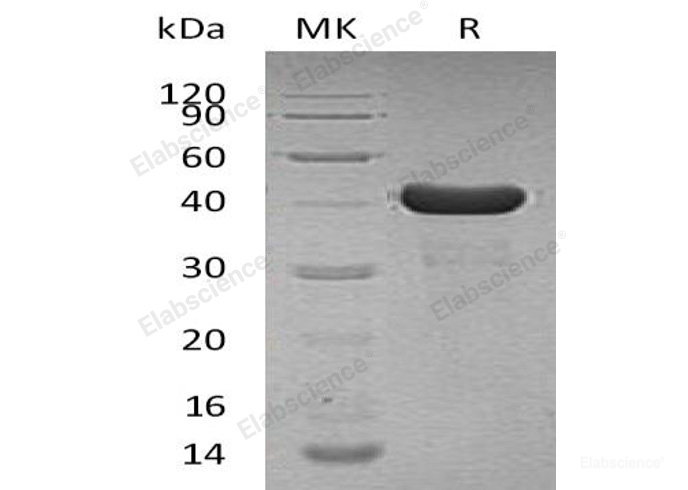 Recombinant Human Peptidyl-Prolyl Cis-Trans Isomerase D/PPID/PPIase D Protein(N, C-6His)-Elabscience