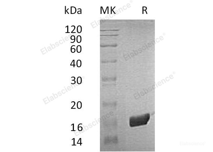 Recombinant Human Peptidyl-Prolyl Cis-Trans Isomerase FKBP2/FKBP22/FKBP13 Protein(C-6His)-Elabscience