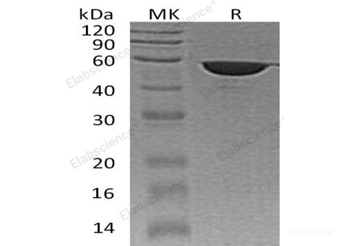 Recombinant Human Peptidyl-Prolyl Cis-Trans Isomerase FKBP4/FKBP4 Protein(C-6His)-Elabscience