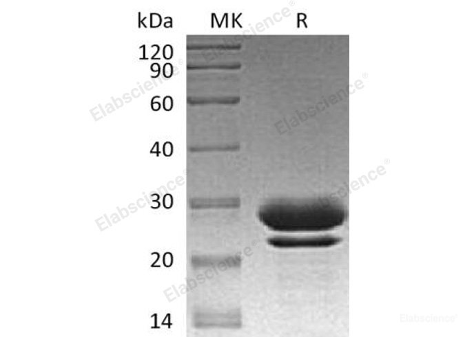 Recombinant Human Peptidyl-Prolyl Cis-Trans Isomerase FKBP7/FKBP7 Protein(C-6His)-Elabscience