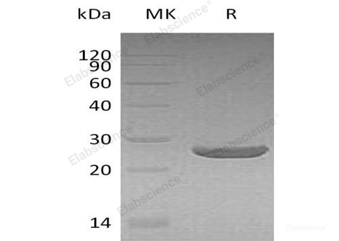 Recombinant Human Peroxiredoxin-1/PRDX1 Protein(N, C-6His)-Elabscience