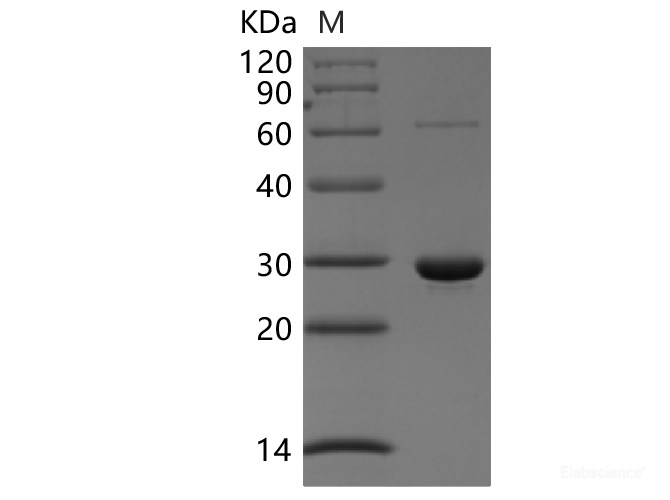 Recombinant Human Peroxiredoxin-4/PRDX4 Protein(N-6His)-Elabscience