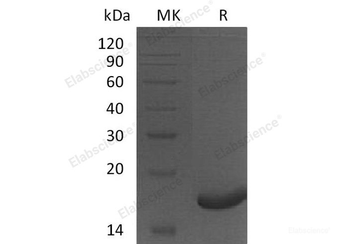 Recombinant Human Peroxiredoxin-5/PRDX5 Protein(N-6His)-Elabscience