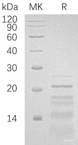 Recombinant Human PH-Like Domain A2/PHLDA2/BWR1C/IPL/TSSC3 Protein(C-6His)-Elabscience