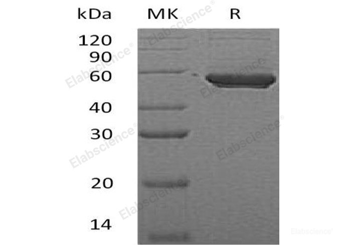 Recombinant Human Phosphatidylinositol 5-Phosphate 4-Kinase 2α/PIP4K2A Protein(C-6His)-Elabscience