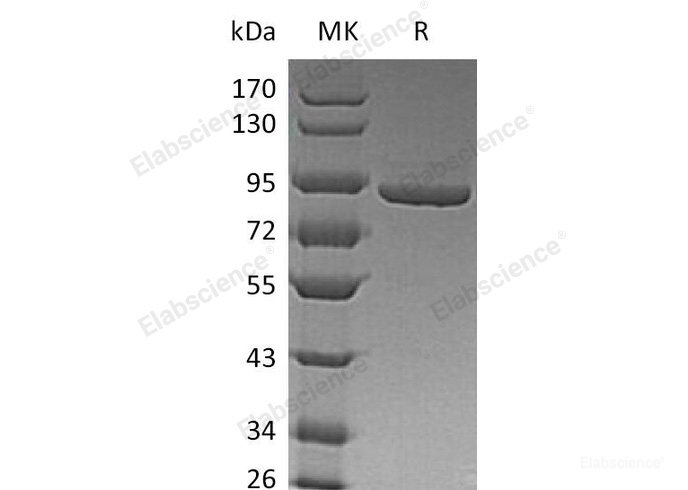 Recombinant Human Phosphofructokinase 1/PFKM/PFKX Protein(C-6His)-Elabscience