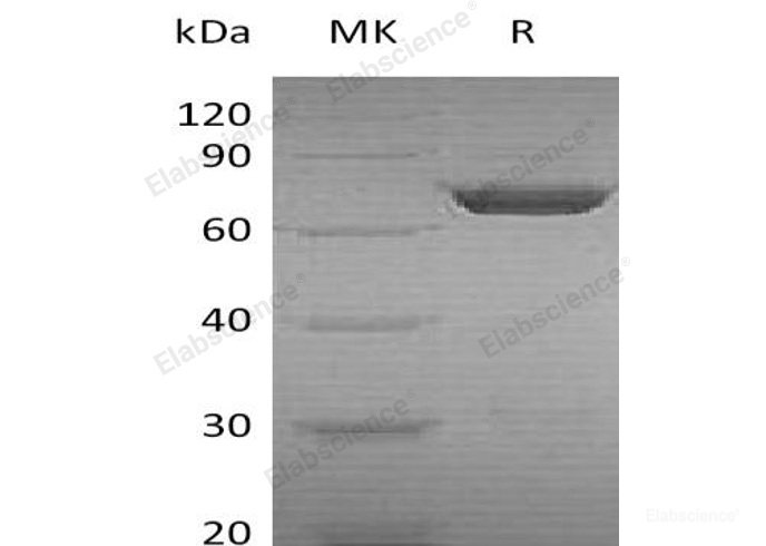 Recombinant Human Phosphoglucomutase 2/PGM2 Protein(N-6His) -Elabscience