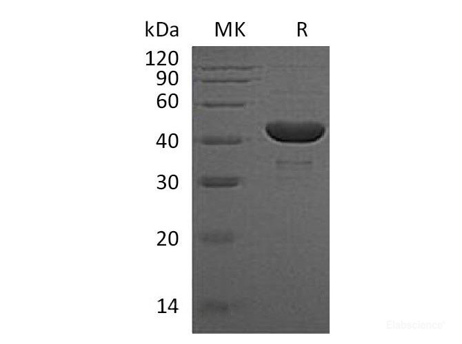Recombinant Human Phosphoglycerate Kinase 1/PGK1 Protein(C-6His)-Elabscience