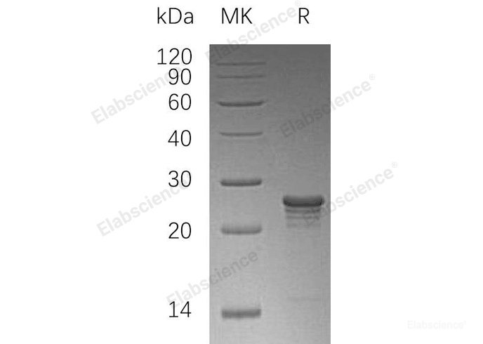 Recombinant Human Phosphomevalonate Kinase/PMVK Protein(N-6His)-Elabscience