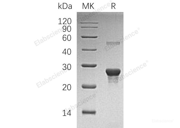 Recombinant Human Phosphopantothenoylcysteine Decarboxylase/PPC-DC Protein(N-6His)-Elabscience