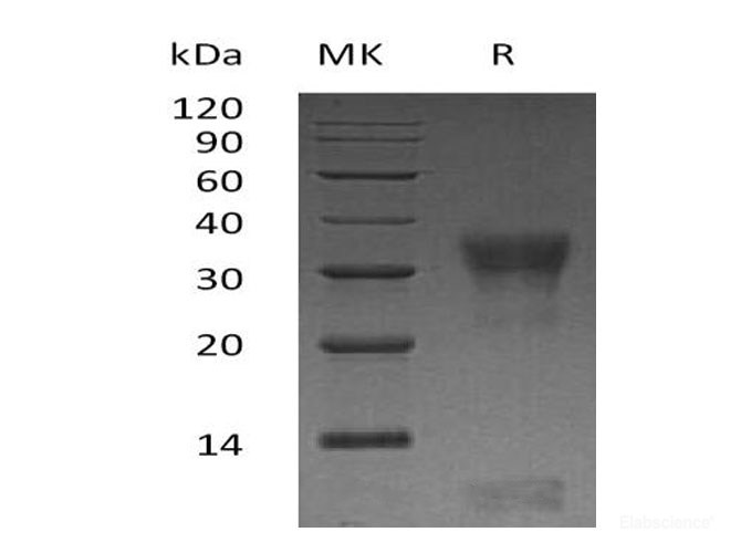 Recombinant Human PI3K-Interacting Protein 1/PIK3IP1 Protein(C-6His)-Elabscience