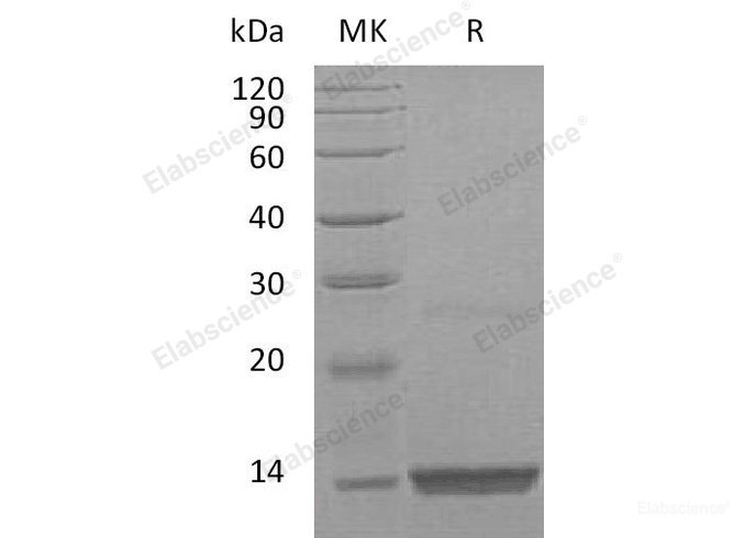 Recombinant Human Platelet-Derived Growth Factor BB/PDGF-BB Protein-Elabscience