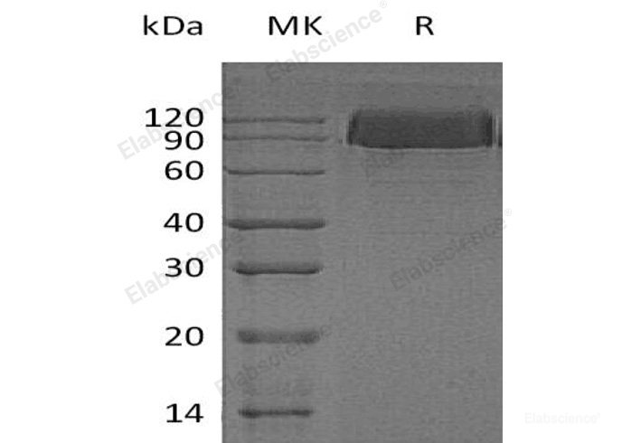 Recombinant Human Platelet-Derived Growth Factor Receptor β/PDGFR-β Protein(C-6His)-Elabscience