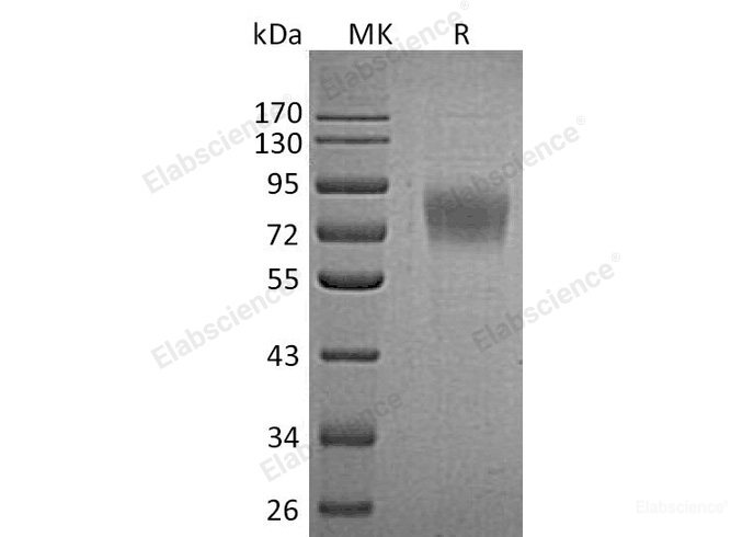 Recombinant Human Plexin Domain-Containing Protein 1/PLXDC1 Protein(C-6His)-Elabscience