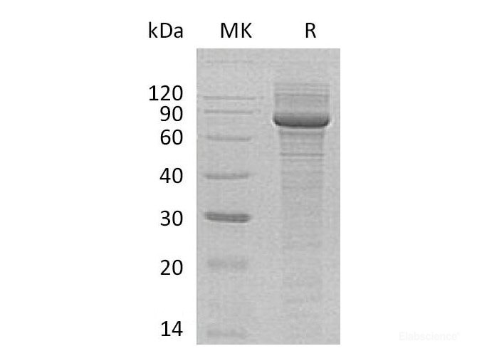 Recombinant Human Polypeptide GalNac Transferase 3/GALNT3 Protein(C-6His)-Elabscience