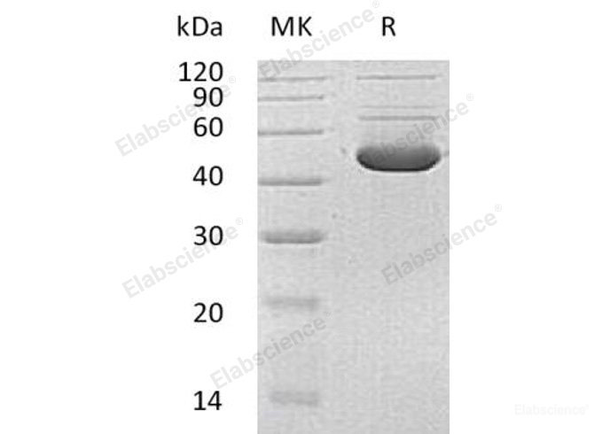 Recombinant Human Porphobilinogen Deaminase/HMBS/PBGD Protein(C-6His)-Elabscience