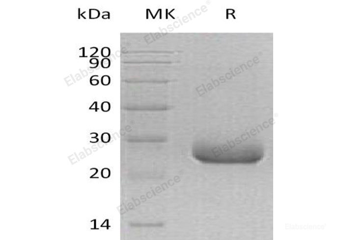 Recombinant Human PRADC1/PAP21 Protein(C-6His)-Elabscience