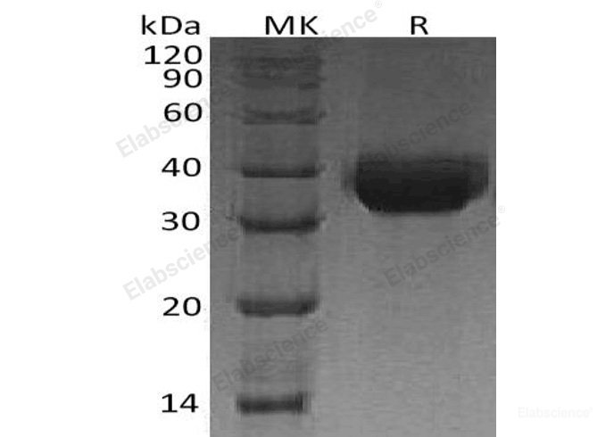 Recombinant Human Preadipocyte Factor-1/Protein δ Homolog 1/Pref-1/DLK-1 Protein(C-6His)-Elabscience
