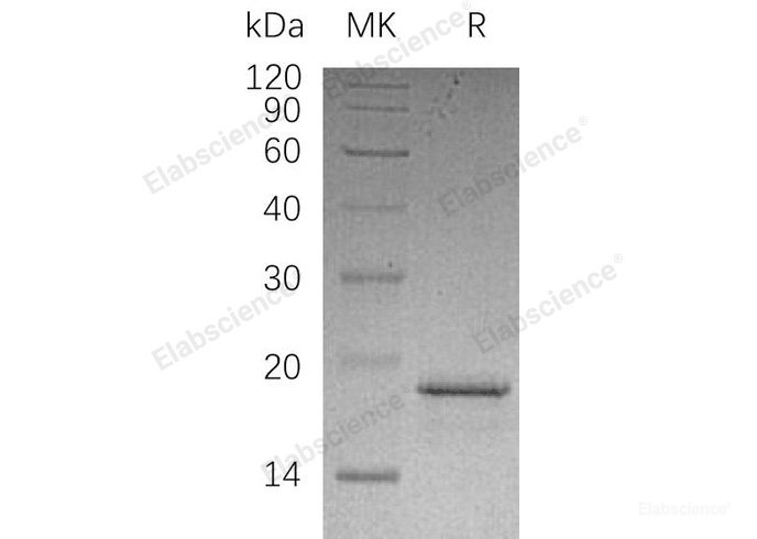 Recombinant Human Prefoldin Subunit 2/PFDN2 Protein(N-6His)-Elabscience