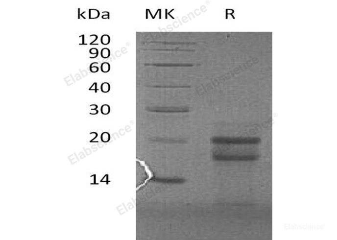 Recombinant Human Prefoldin Subunit 4/PFDN4 Protein(N-6His)-Elabscience
