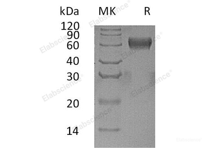 Recombinant Human Pregnancy-Specific β-1-Glycoprotein 1/PSG1 Protein(C-6His)-Elabscience