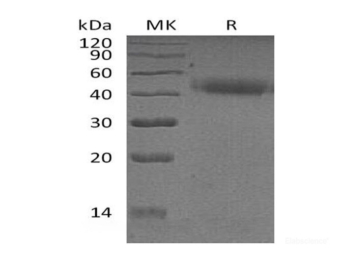 Recombinant Human Pregnancy-Specific β-1-Glycoprotein 2/PSG2 Protein(C-6His)-Elabscience