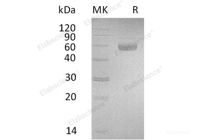 Recombinant Human Pregnancy-Specific β-1-Glycoprotein 3/PSG3 Protein(C-6His)-Elabscience