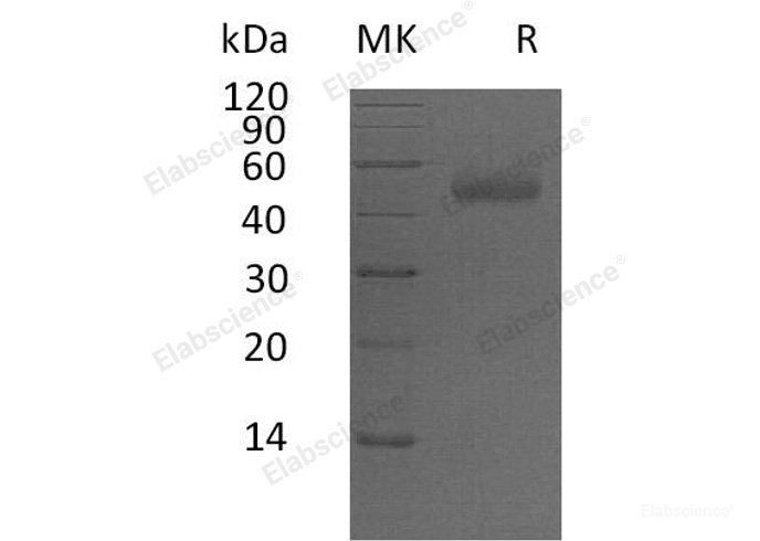 Recombinant Human Pregnancy-Specific β-1-Glycoprotein 5/PSG5 Protein(C-6His)-Elabscience