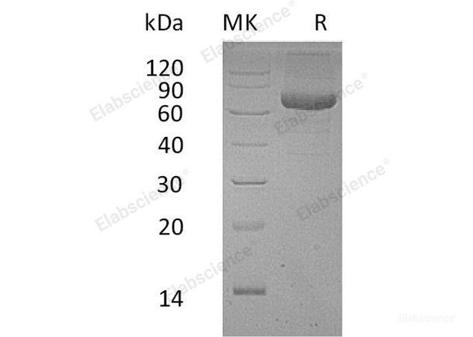 Recombinant Human Pregnancy-Specific β-1-Glycoprotein 9/PSBG9 Protein(C-6His)-Elabscience