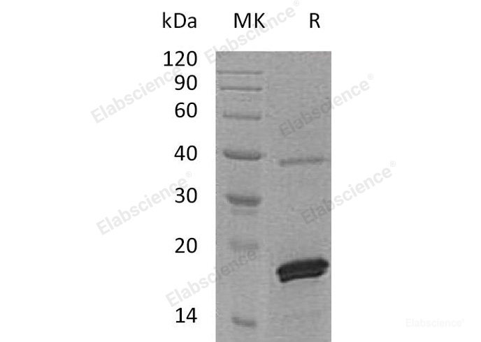 Recombinant Human PRL- 2/PTP4A2 Protein(C-6His)-Elabscience