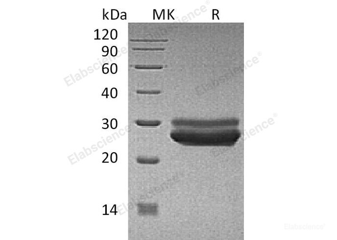 Recombinant Human PRL Protein-Elabscience