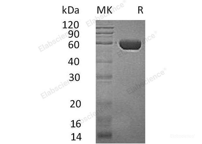 Recombinant Human Probable Serine Carboxypeptidase CPVL/VCP-Like Protein Protein(C-6His)-Elabscience