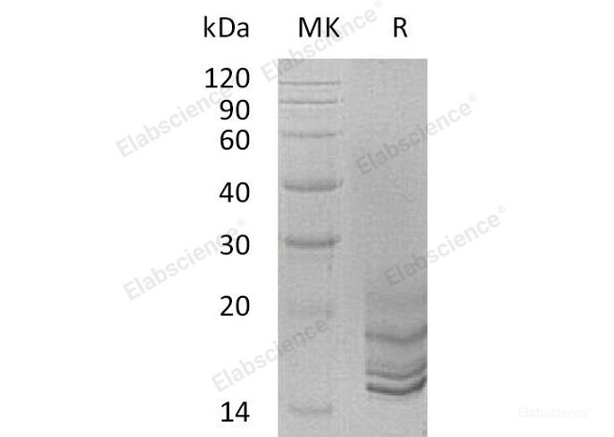 Recombinant Human Progonadoliberin-2/GNRH2 Protein(C-6His)-Elabscience