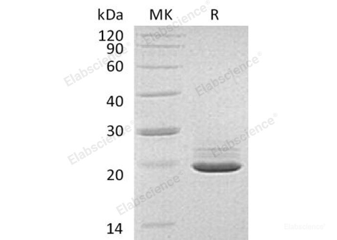 Recombinant Human Proline-Rich Acidic Protein 1/PRAP1 Protein(C-6His)-Elabscience
