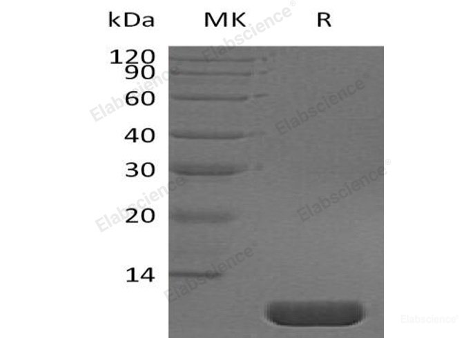 Recombinant Human Pro-Neuregulin-1/NRG1β1/HRG1-β1(Ser177-Glu241) Protein-Elabscience