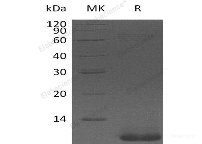 Recombinant Human Pro-Neuregulin-1/NRG1β1/HRG1β1(Thr176-Lys246) Protein-Elabscience