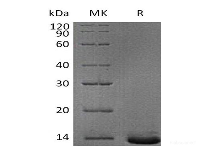 Recombinant Human Pro-Neuropeptide Y/NPY Protein(C-6His)-Elabscience
